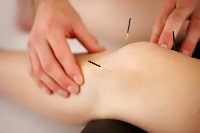 Prickly Truths: Understanding Muscle Pain After Acupuncture
