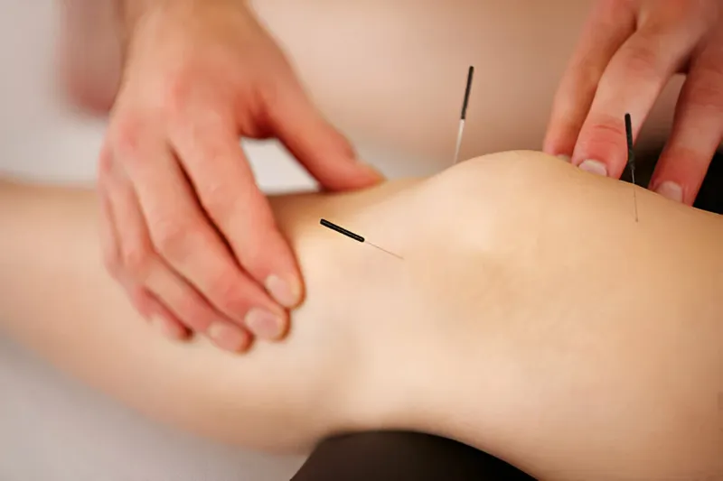 Prickly Truths: Understanding Muscle Pain After Acupuncture
