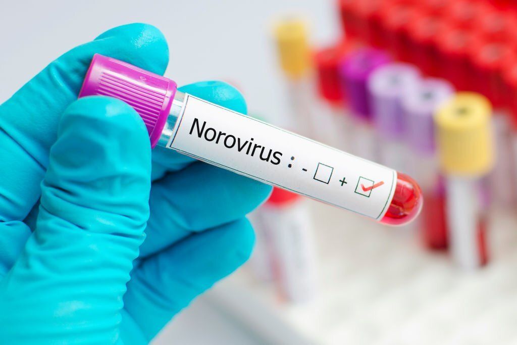 Norovirus Immunity: 5 Ways to Prevent Infections