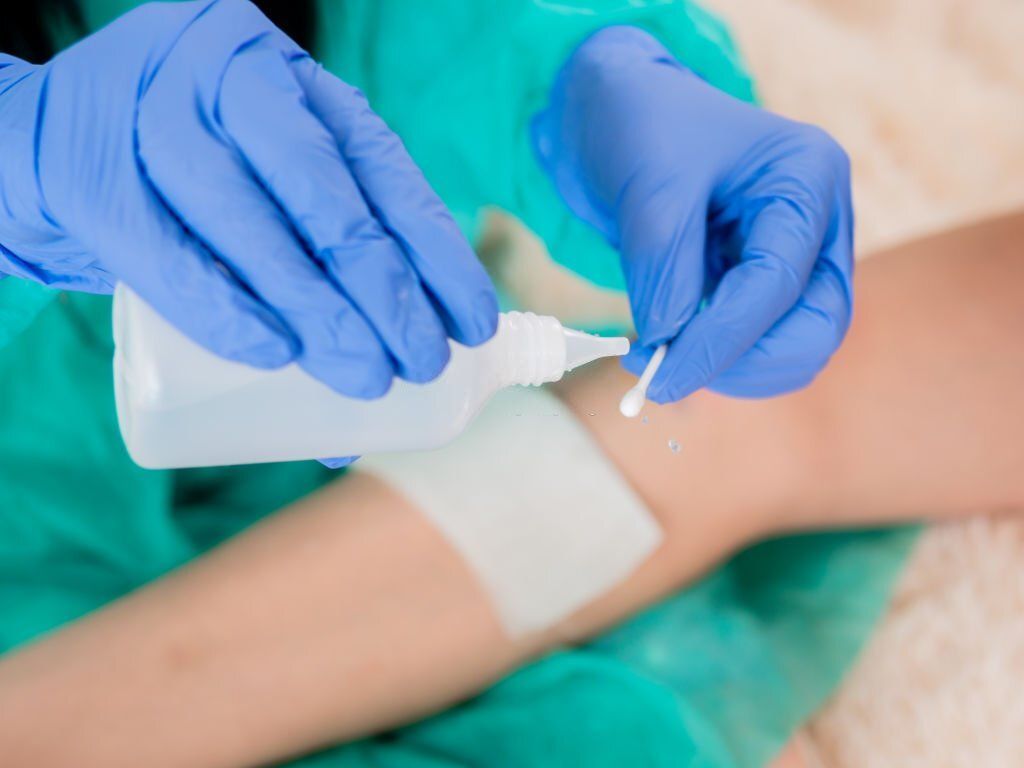 Escharotic Treatment: The Risks and Benefits