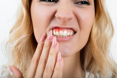 Is Gingivitis Curable? Yes, And Here is How