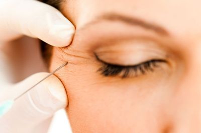Botox For The Eyes: What to Expect Before and After?