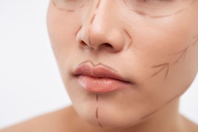 Facial Transformation: Facial Feminization Surgery Before & After