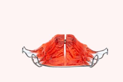 Jaw-Dropping Transformations: Palate Expander Before and After