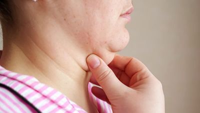 Triple Chin: Natural and Surgical Methods to Reduce Chin Fat