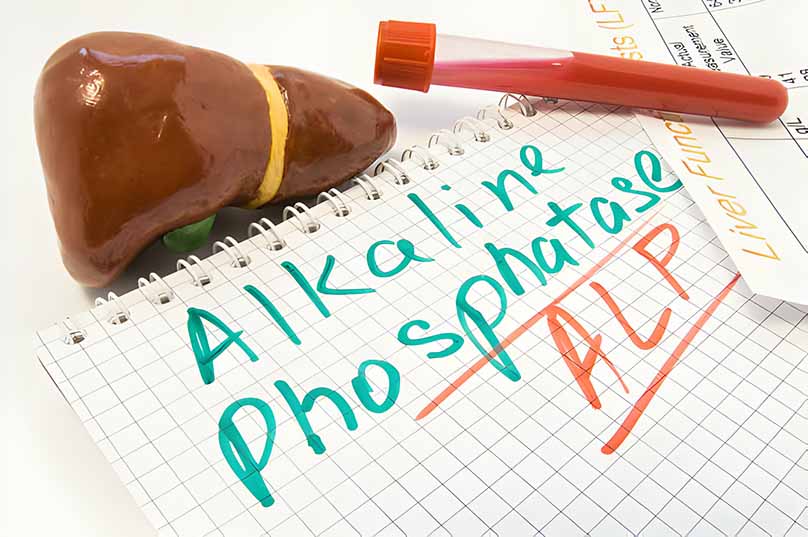 Understanding Alkaline Phosphatase (ALP): A Key Marker for Health